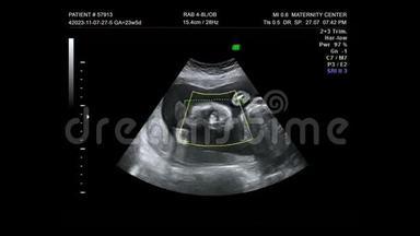 幼母<strong>孕婴</strong>儿胚胎超声3D4D